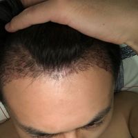 發(fā)際線用戶圖片