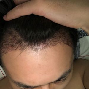 发际线分享社区