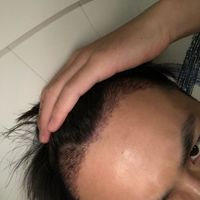 發(fā)際線用戶圖片