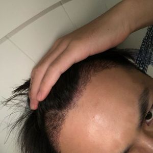 发际线分享社区