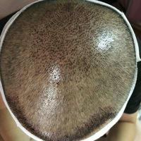 禿頂用戶圖片