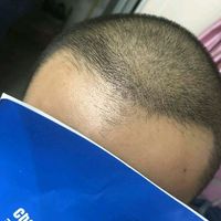 發(fā)際線用戶圖片