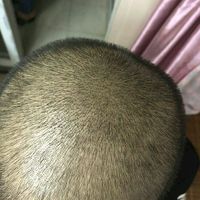 發(fā)際線用戶圖片