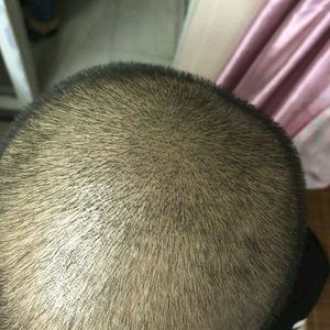 发际线分享社区