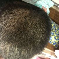 發(fā)際線用戶圖片