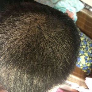 发际线分享社区