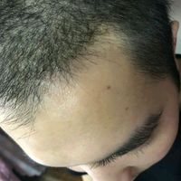 發(fā)際線用戶圖片