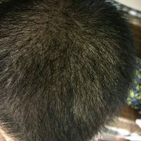 發(fā)際線用戶圖片