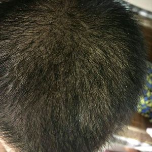 发际线分享社区