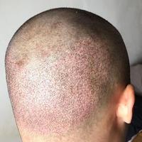 發(fā)際線用戶圖片