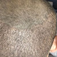 發(fā)際線用戶圖片