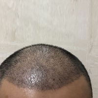 發(fā)際線用戶圖片