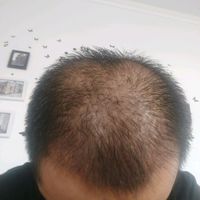 發(fā)際線用戶圖片