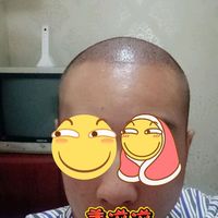 發(fā)際線用戶圖片