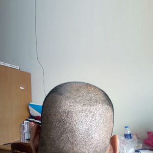 发际线分享社区