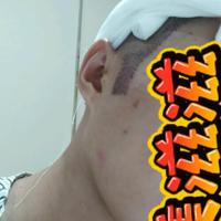 種植鬢角用戶圖片