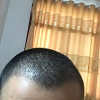發(fā)際線用戶圖片