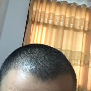 发际线分享社区
