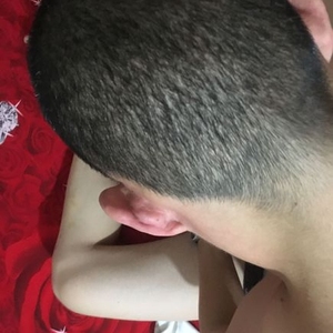 发际线分享社区