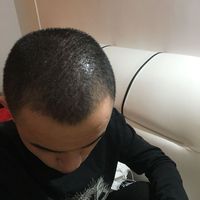 發(fā)際線用戶圖片