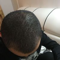 發(fā)際線用戶圖片
