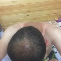 禿頂用戶圖片