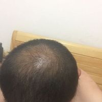 禿頂用戶圖片