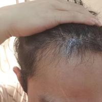 發(fā)際線用戶圖片