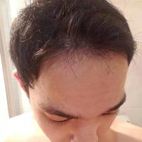 發(fā)際線用戶圖片