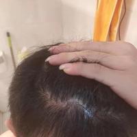 發(fā)際線用戶圖片