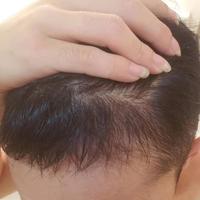 發(fā)際線用戶圖片