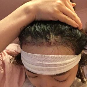 发际线分享社区