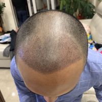 發(fā)際線用戶圖片