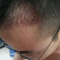 發(fā)際線用戶圖片