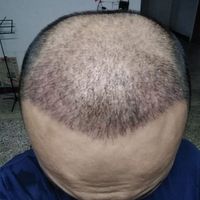 發(fā)際線用戶圖片