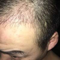 發(fā)際線用戶圖片