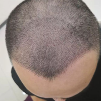 發(fā)際線用戶圖片