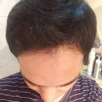 發(fā)際線用戶圖片
