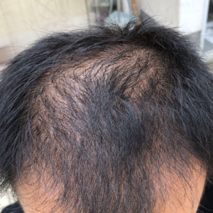 发际线分享社区