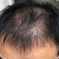 發(fā)際線用戶圖片