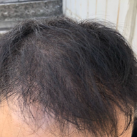 發(fā)際線用戶圖片