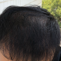 發(fā)際線用戶圖片