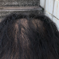 發(fā)際線用戶圖片