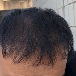 发际线分享社区
