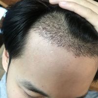 發(fā)際線用戶圖片