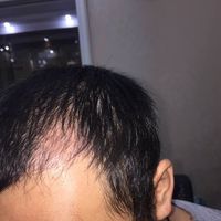 發(fā)際線用戶圖片