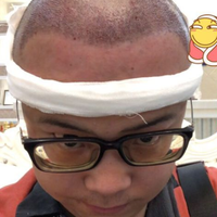 發(fā)際線用戶圖片