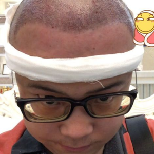 发际线分享社区