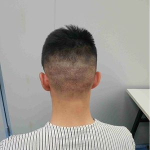 发际线分享社区