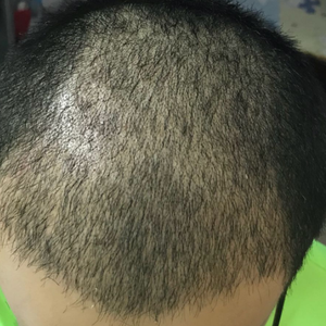 发际线分享社区